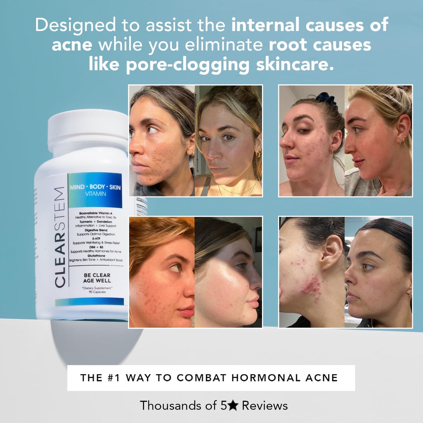 MINDBODYSKIN Hormonal Acne Supplement
