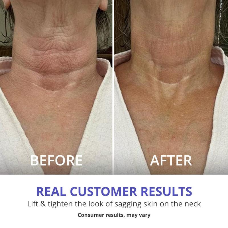 GOPURE Tighten & Lift Neck Cream | Buy 1, Get 1 Free