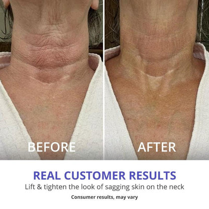 GOPURE Tighten & Lift Neck Cream | Buy 1, Get 1 Free