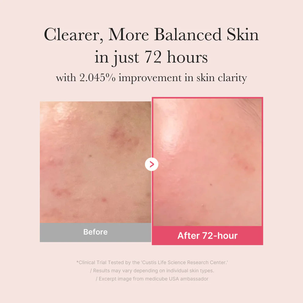 The Power Couple l TXA Niacinamide 15% Glow Serum + Azelaic Acid 16 Calming Serum